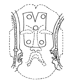Figure 5b. Incised Image of maskette in Figure 5a