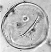 Figure 2a. Photomicrographs of pollen grains. Small Zea sp. (ca. 4200 cal B.C., 49 mcm diameter). Figure 2a. Photomicrographs of pollen grains. Small Zea sp. (ca. 4200 cal B.C., 49 mcm diameter).