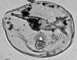 Figure 2b. Photomicrographs of pollen grains. Maize (ca. 1500 cal B.C., 92 mcm diameter).