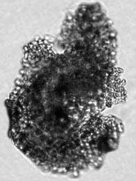 Figure 2c. Photomicrographs of pollen grains. Manihot sp. (ca. 4600 cal B.C.; maximum diameter of the fragmentary grain is 92 mcm; original grain is likely to have been in excess of 150 mcm). Figure 2c. Photomicrographs of pollen grains. Manihot sp. (ca. 4600 cal B.C.; maximum diameter of the fragmentary grain is 92 mcm; original grain is likely to have been in excess of 150 mcm).